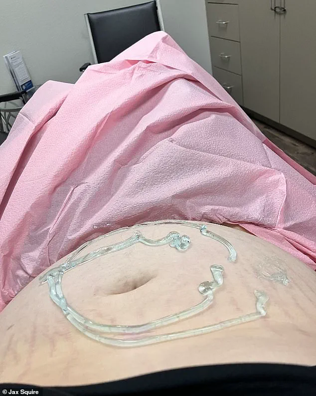 Late-Breaking: Transgender Man in Graham, Texas to Give Up Baby for Adoption After Previous Miscarriage