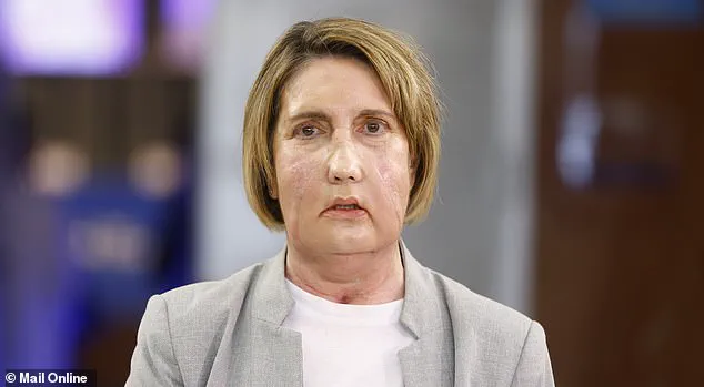 Barcelona Hospital Achieves World's First Facial Transplant from Assisted Dying Donor