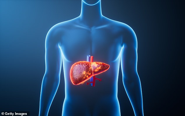 Obesity and Alcohol Combine to Surge Liver Disease Across US